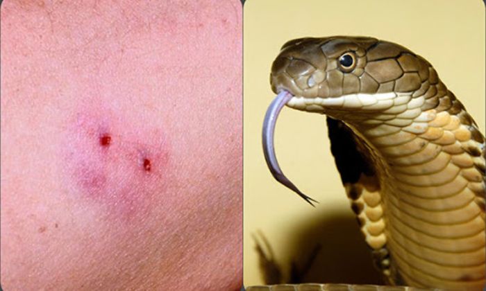 Ngủ mơ thấy rắn hổ mang cắn mình là một điềm báo rất nguy hiểm